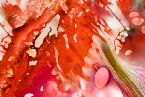 My Blood is a Garden